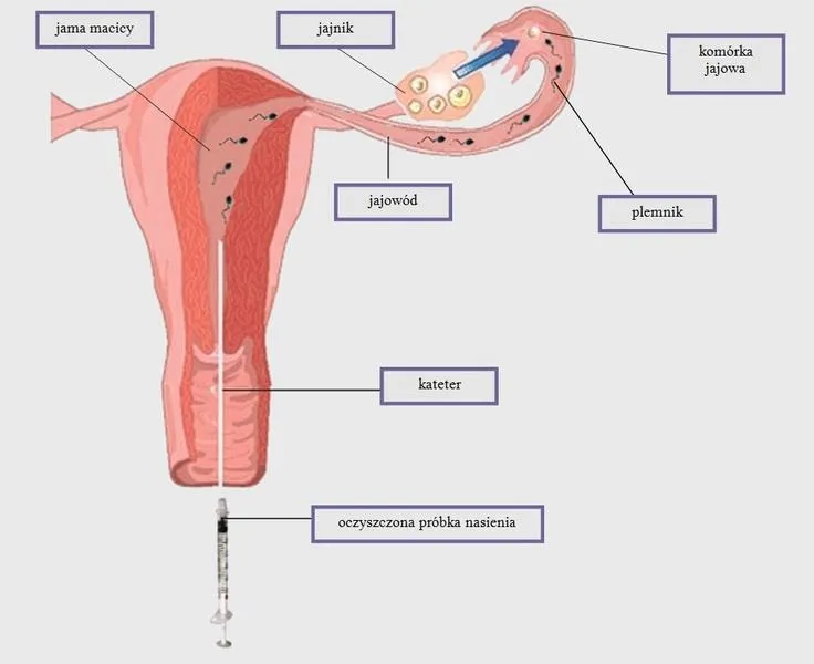 Jak skutecznie przewieźć nasienie do inseminacji: praktyczne porady i wskazówki