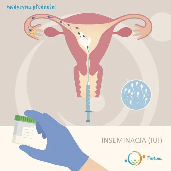 Przewóz nasienia do inseminacji